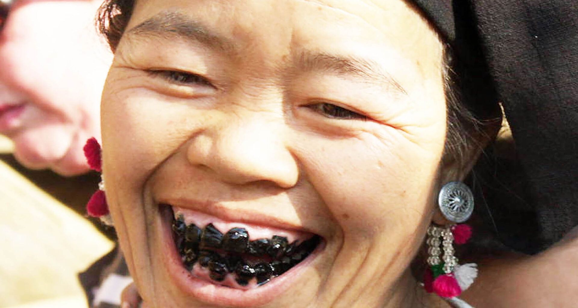Tooth blackening beauty trend in Vietnam began 2,000 years ago