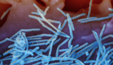 RSV shots for babies under FDA review despite evidence of safety : NPR