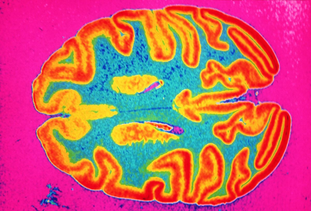 An abstract representation of a human brain displayed in vivid colors, predominantly pink, blue, and yellow. The brain's intricate neural pathways are depicted with a stylized and colorful design, highlighting the complexity and connectivity of the brain's structure.