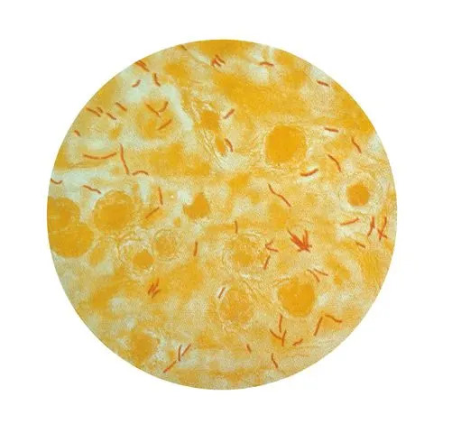 Microscopic view of mycobacterium tuberculosis bacteriaCredit: Smith Collection/Gado/Getty