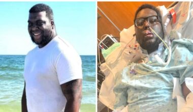 Man Endures Sepsis and Triple Amputation After Routine Dental Exam