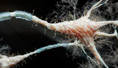 Multiple Sclerosis: The Hidden Truth About Its Two Strikingly Different Forms