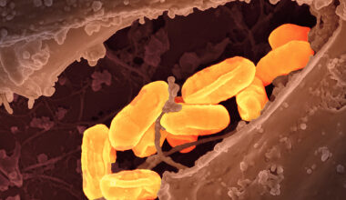 Dangerous disease 'old as the plague' hits record high in California