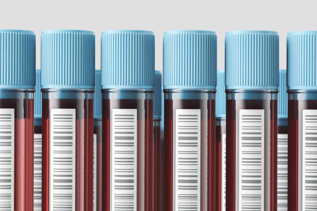 Vertical test tubes with blood with blue lids ready for test. Concept of medicine and science. 3d rendering