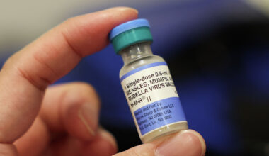 S.F. infant diagnosed with measles, city’s first case in 7 years
