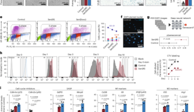 p21+TREM2+ senescent macrophages fuel inflammaging and metabolic dysfunction-associated steatotic liver disease