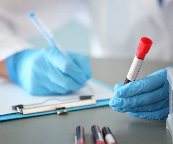 scientist looking at blood sample