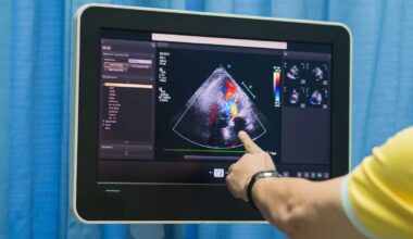 Stay ahead of health issues: Echo Ultrasound's $400 comprehensive body scan