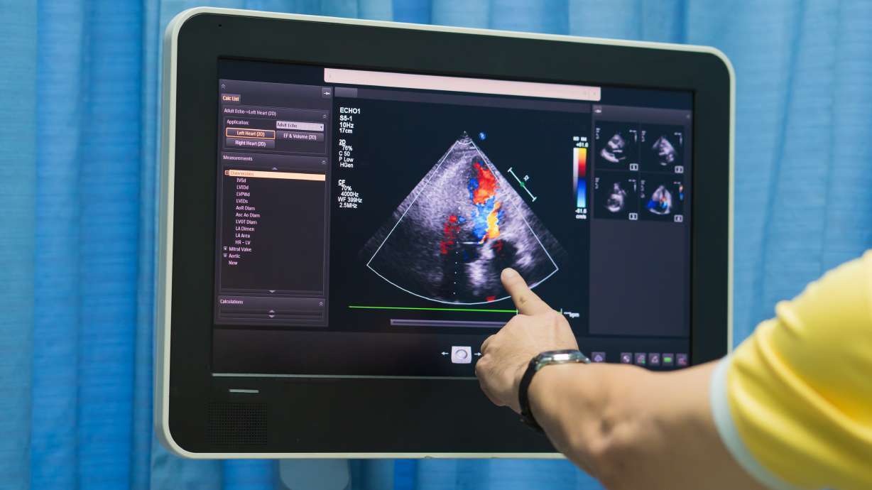 Stay ahead of health issues: Echo Ultrasound's $400 comprehensive body scan