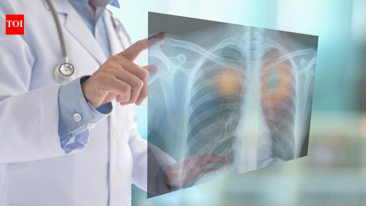 Lung Cancer: Misdiagnosed as TB, this 28-year-old had lung cancer: The one pill that turned his life around