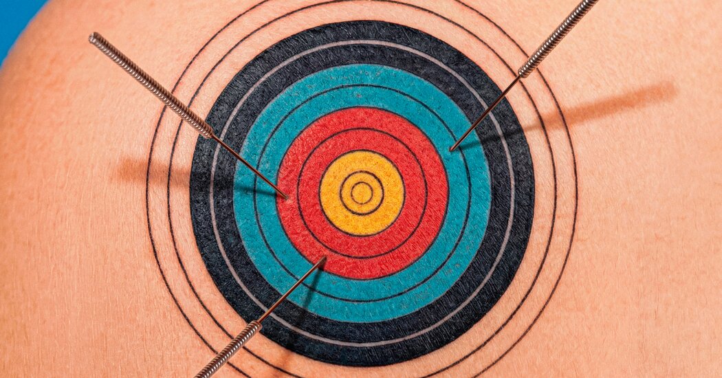 What Is Dry Needling? And Does It Work?