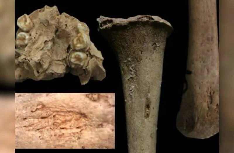 Prehistoric Vietnamese children's bones and teeth bearking marks of syphilis-like disease, April 11, 2026. (credit: Dr. Melandri Vlok/Charles Sturt University)