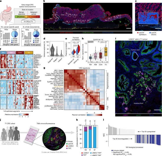 Emergence of oncofetal plasticity is ubiquitous in early colorectal cancers