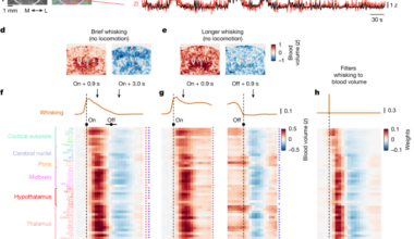 Brainwide blood volume reflects opposing neural populations