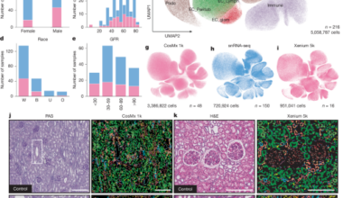 Spatial atlas of diabetic kidney disease reveals a B cell-rich subgroup
