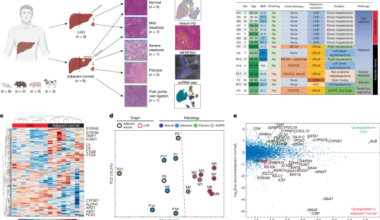A spatial atlas of the healthy human liver from live donors