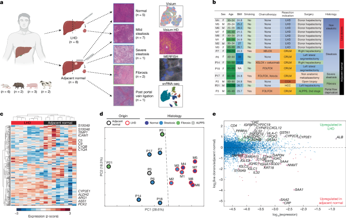 A spatial atlas of the healthy human liver from live donors
