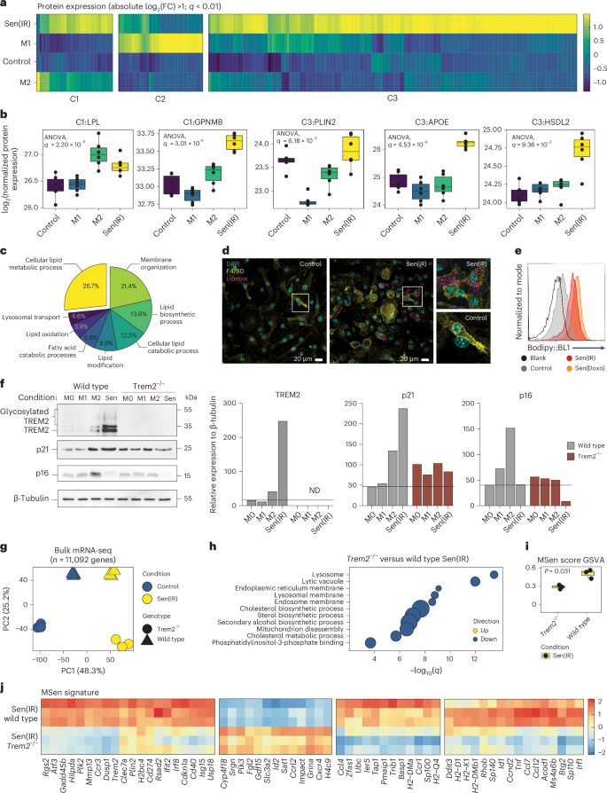Fig. 4: Senescent macrophages are TREM2+p21+ and form lipid droplets.