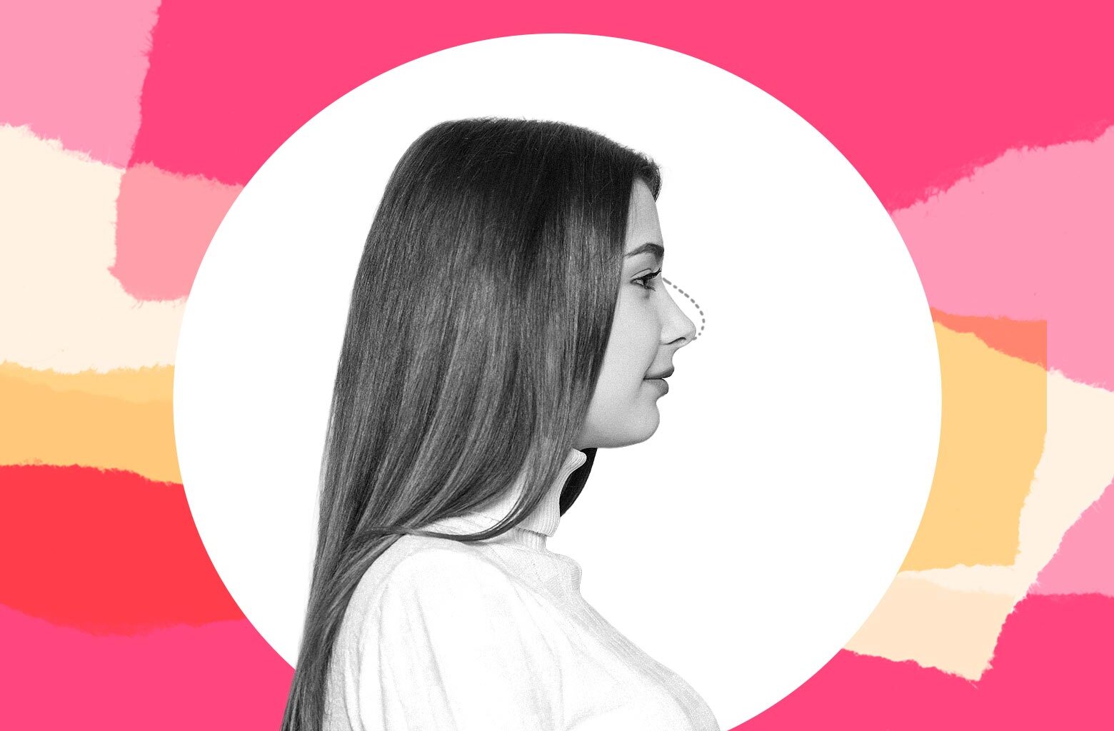 I helped my 16-year-old niece get a nose job. I don't her parents will ever forgive me.