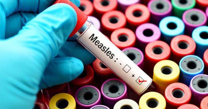 State reports measles case, warns of exposure in Kenner | Health care/Hospitals