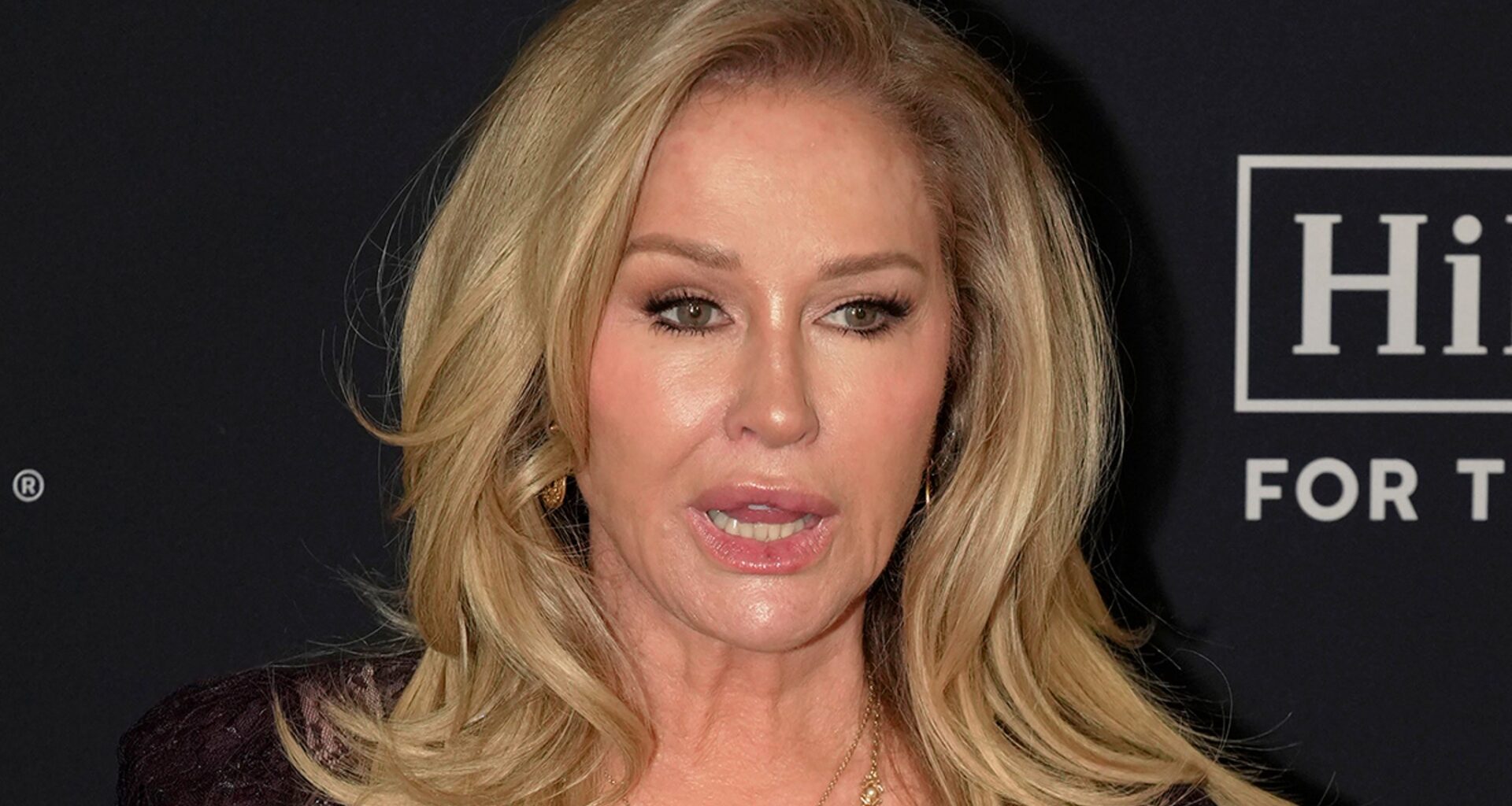 'RHOBH' Star Kathy Hilton's Injured House Guest Demanding $55K Per Year