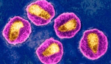 An image of the HIV virus taken with transmission electron microscopy.