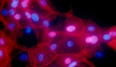 Study finds missed opportunities for targeted cancer treatments