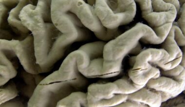 UCSD researchers work on way to prevent Alzheimer’s disease with molecular ‘switch’ – San Diego Union-Tribune