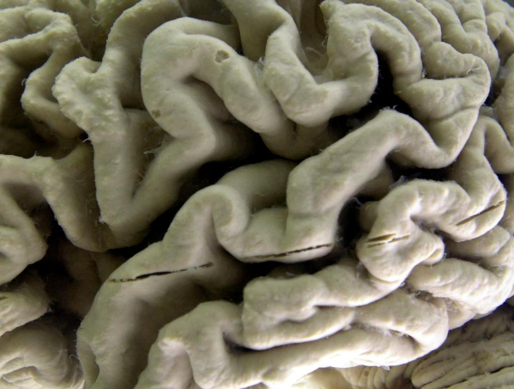 UCSD researchers work on way to prevent Alzheimer’s disease with molecular ‘switch’ – San Diego Union-Tribune
