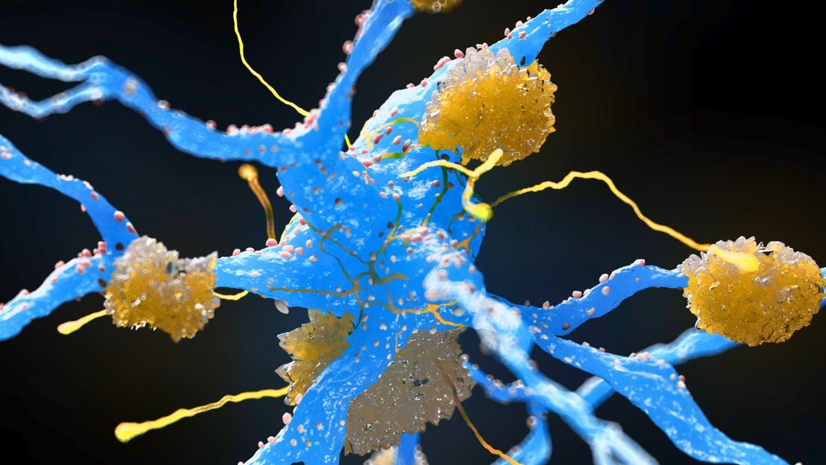 Weight-Loss Drugs May Reduce Buildup of Alzheimer's Proteins, Major Review Finds : ScienceAlert