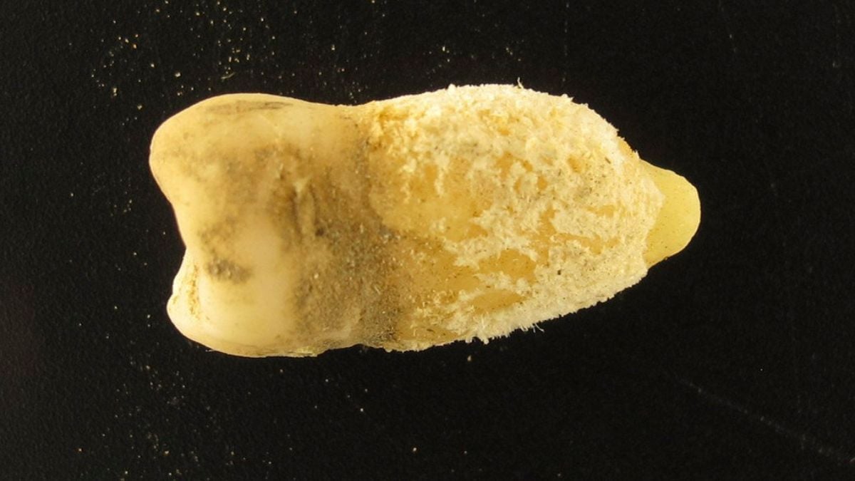 A Bolivian Mummy's Tooth Is Rewriting The History of Scarlet Fever : ScienceAlert