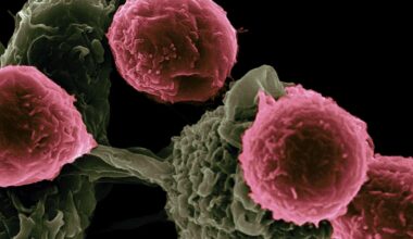 Revolutionary Therapy Cured Three "Incurable" Autoimmune Diseases in a Patient