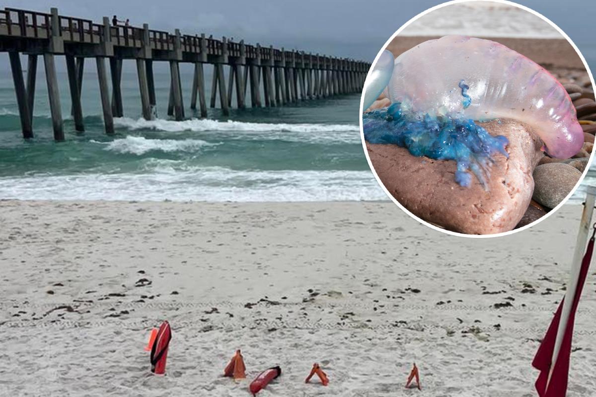 Stinging Portuguese man o' war are invading beaches: 'Extremely painful'
