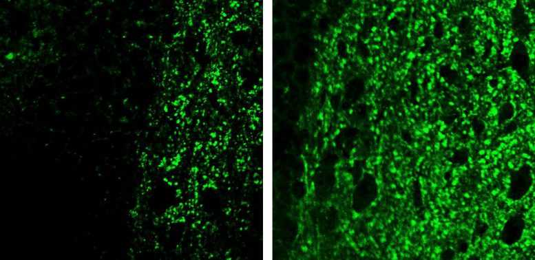 Connections Between Nerve Cells in the Brain Alzheimer’s