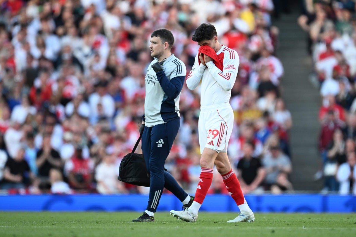 Arsenal optimistic Kai Havertz has avoided serious injury, hopeful of return before end of season