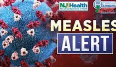 NJ Confirms First Measles Case of 2026; Possible Exposure Sites Identified in Newark, Hackensack