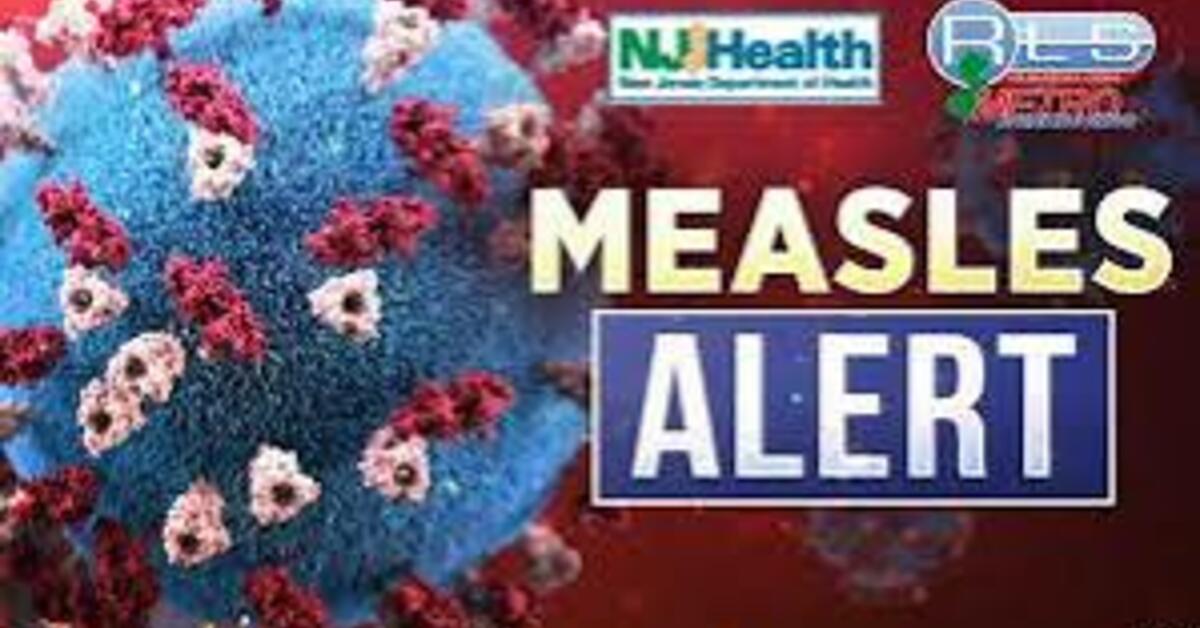 NJ Confirms First Measles Case of 2026; Possible Exposure Sites Identified in Newark, Hackensack