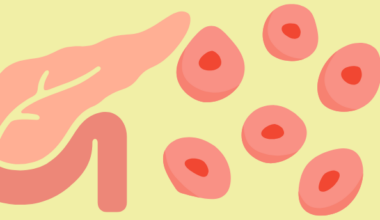Implantable Islet Cells Could Control Type 1 Diabetes