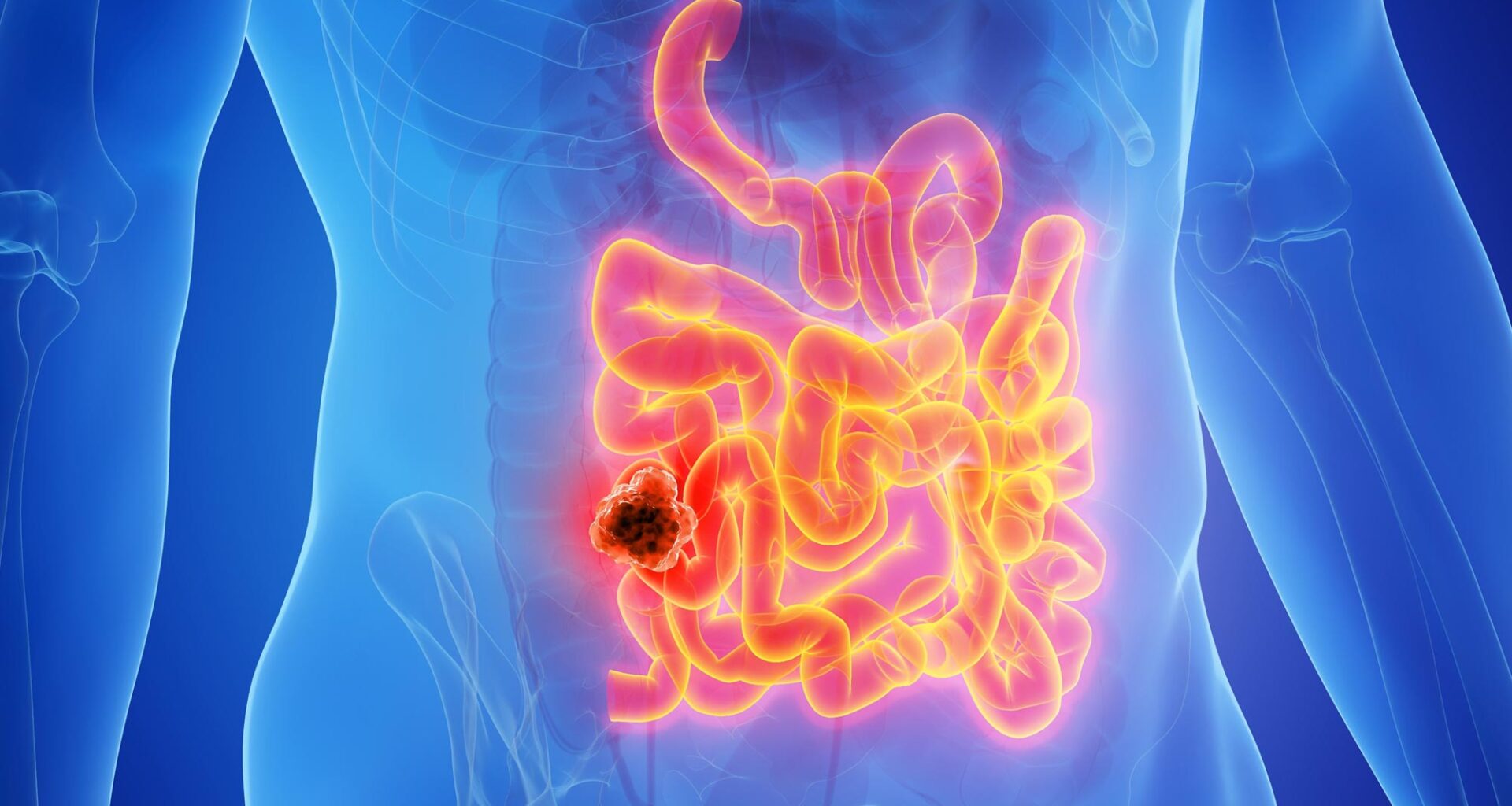 Male Anatomy Cancer Small Intestine