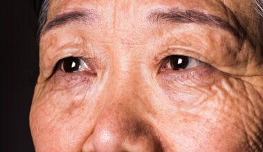Your Vision Can Predict Dementia 12 Years Before a Diagnosis, Study Suggests : ScienceAlert