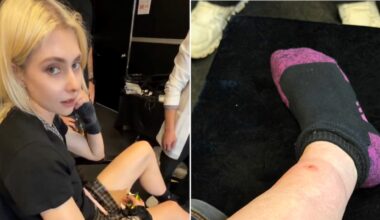 Taylor Momsen Bit By Venomous Spider on AC/DC Tour After Previously Being Bit by Bat