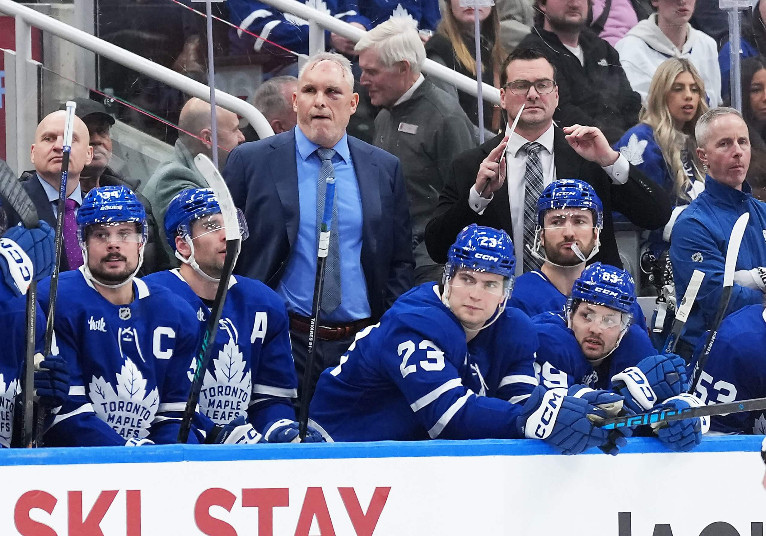 Craig Berube stands behind the Leafs bench with a noticeable head wound and black eye.