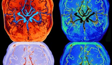 Scientists Watch Brain’s Self-Cleaning Process During Sleep in Real Time