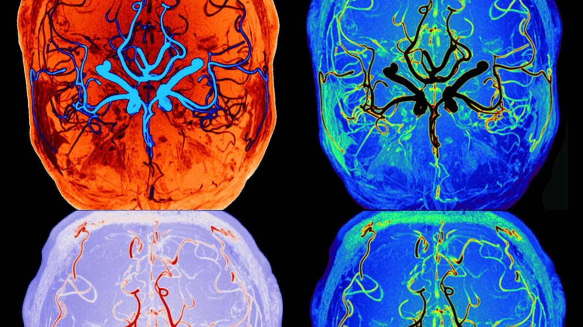 Scientists Watch Brain’s Self-Cleaning Process During Sleep in Real Time