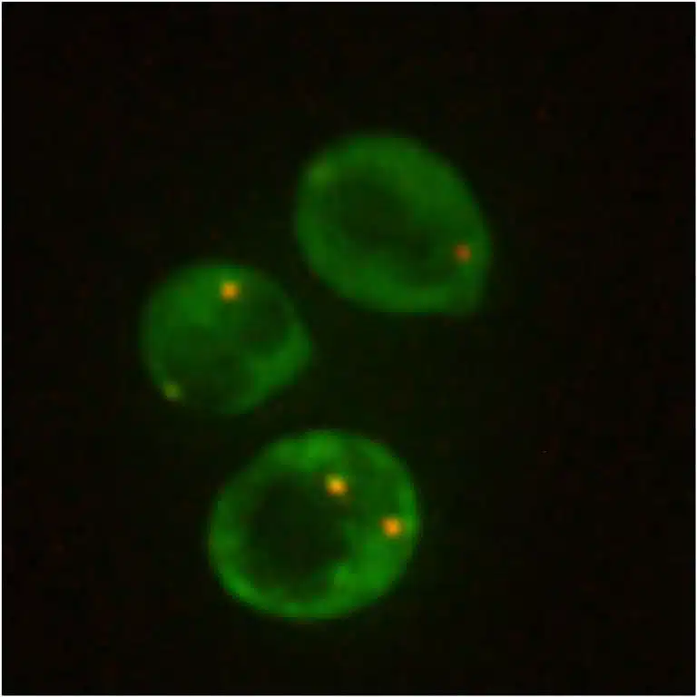 Yeast Cells Forming Tiny Rnp Clusters (yellow Dots) When Under Stress
