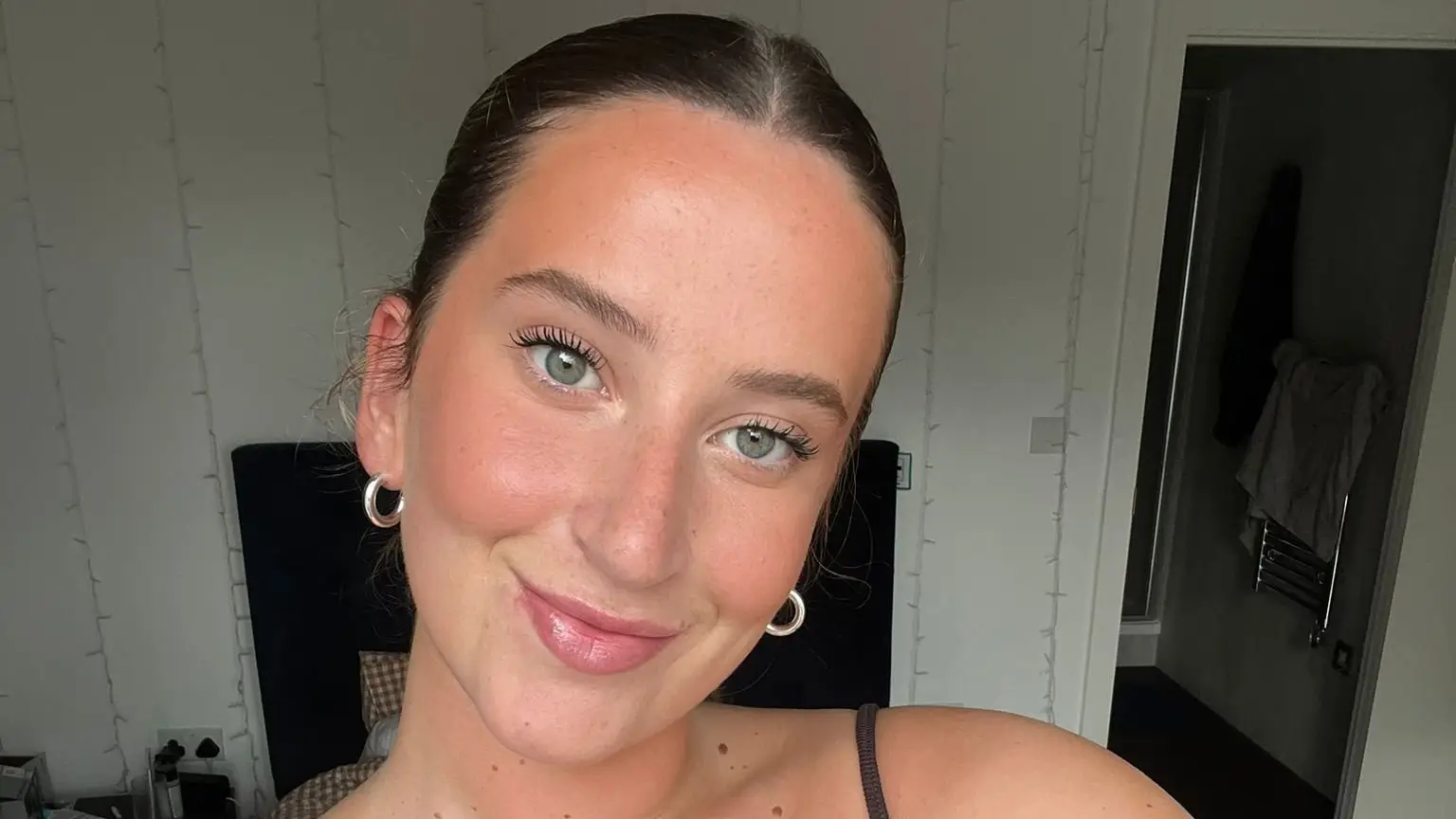 Molly is raising awareness of the condition (SWNS)