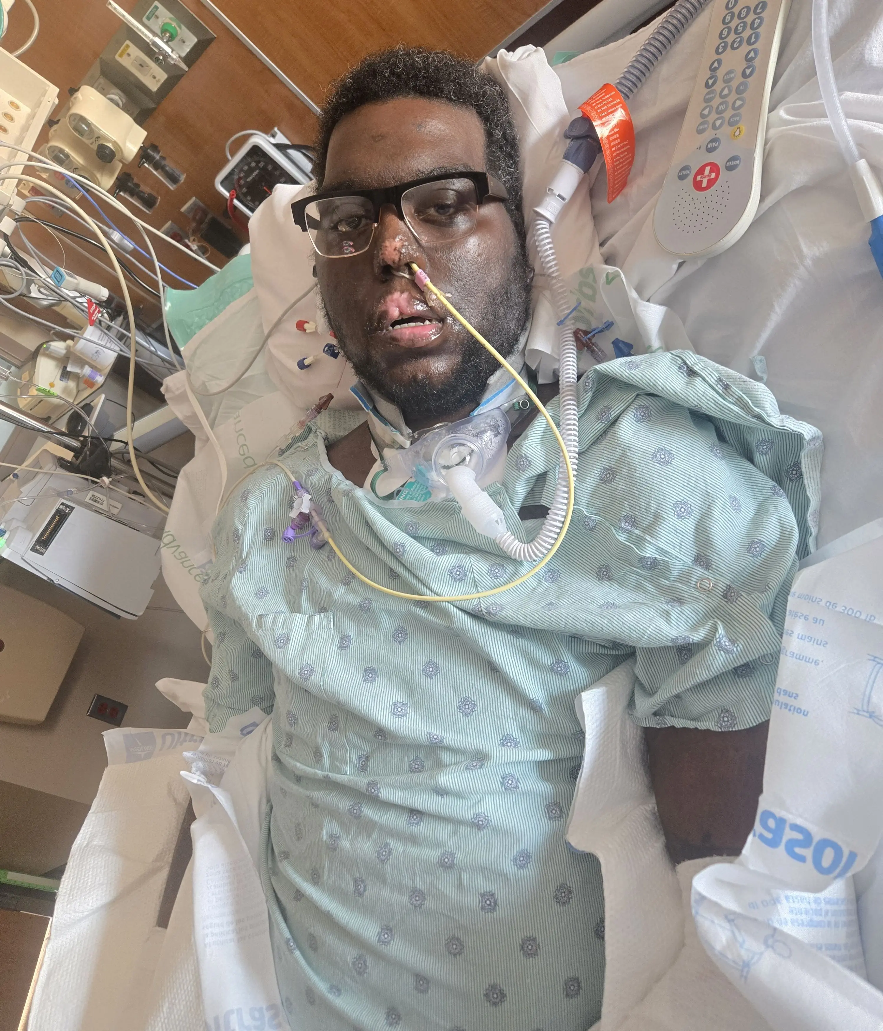 34-year-old Davon has had his limbs amputated to save his life (Kennedy)