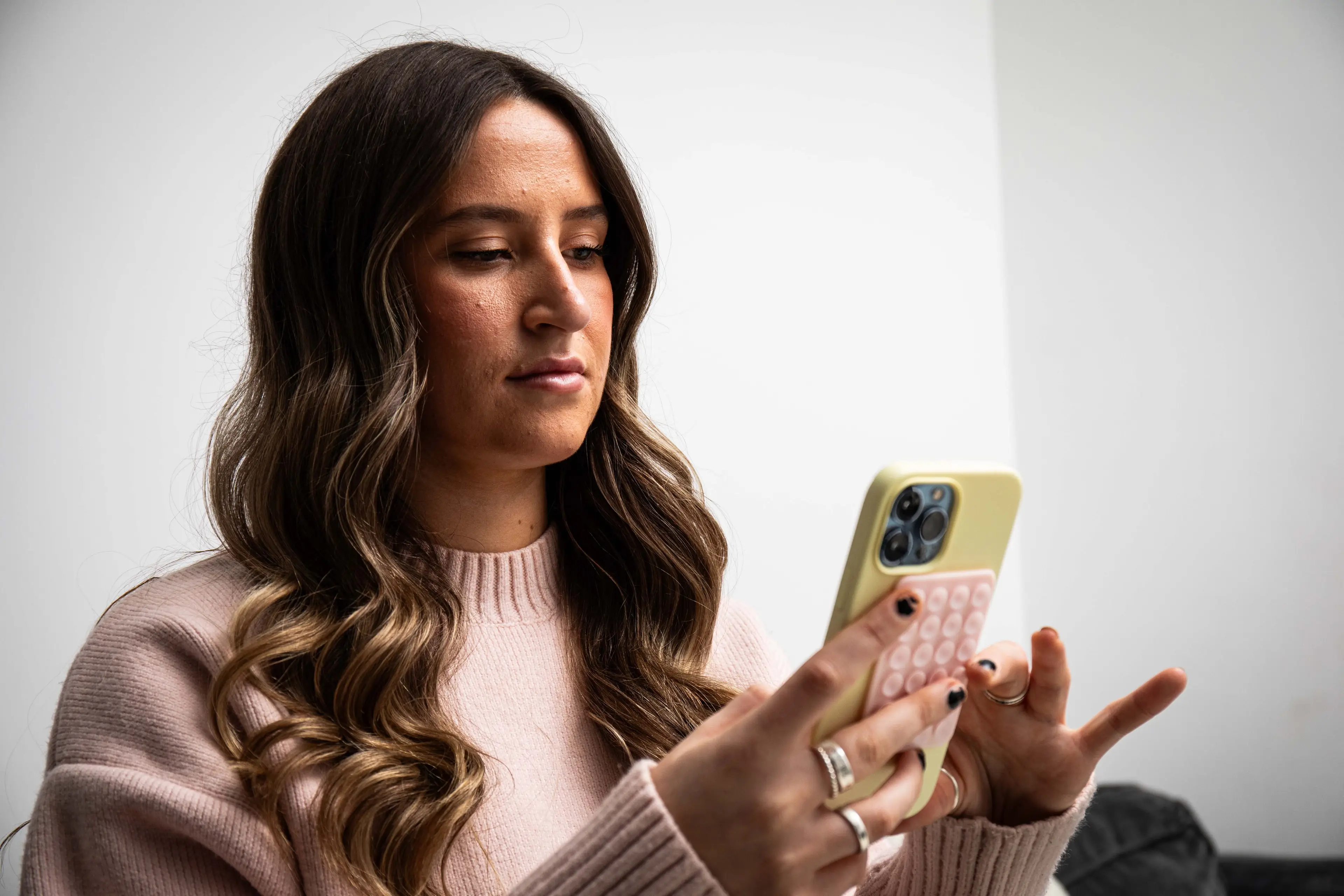 Molly came forward about her condition earlier this year (SWNS)