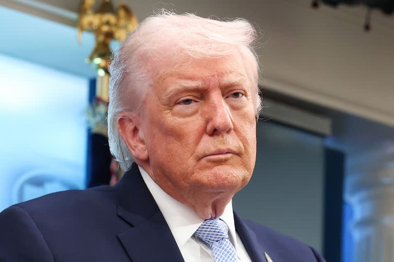 President Donald Trump speaks during a news conference