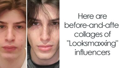 From Bone Smashing To Chin Extensions, Here Are Before-And-After Collages Of "Looksmaxxing" Influencers